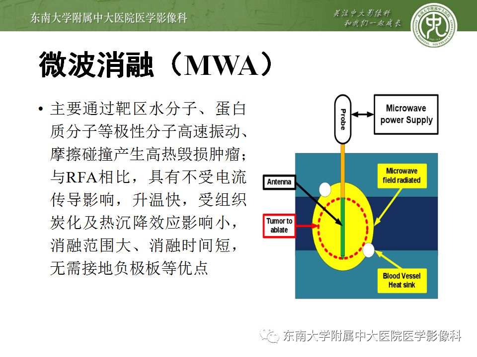 【病例】肝癌介入术后消融区凝固性坏死1例CT影像表现