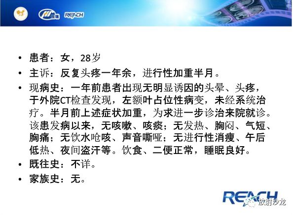 【病例】颅内软骨瘤1例MR影像表现
