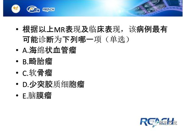【病例】颅内软骨瘤1例MR影像表现