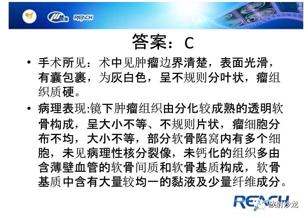 【病例】颅内软骨瘤1例MR影像表现
