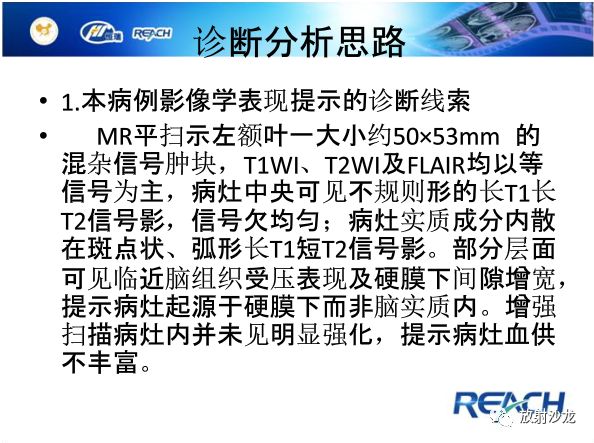 【病例】颅内软骨瘤1例MR影像表现