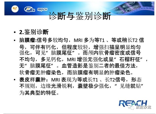 【病例】颅内软骨瘤1例MR影像表现