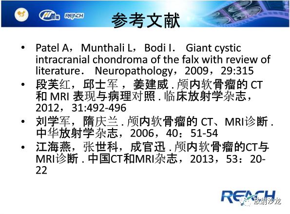 【病例】颅内软骨瘤1例MR影像表现
