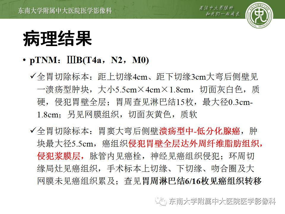 【病例】胃癌1例影像诊断与分期