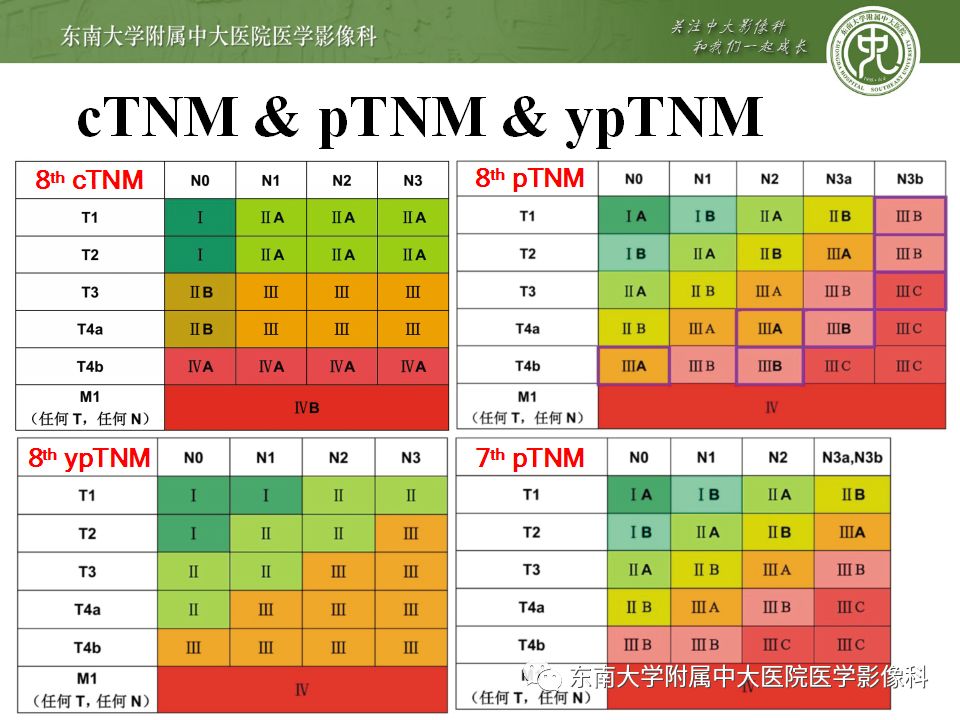 【病例】胃癌1例影像诊断与分期