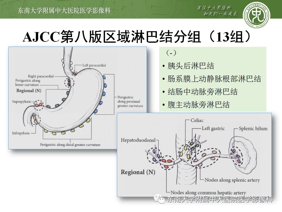 【病例】胃癌1例影像诊断与分期