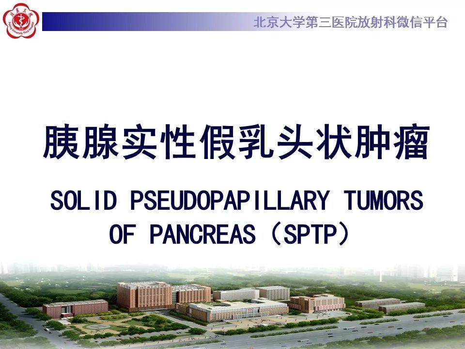 【病例】胰腺实性假乳头状瘤1例CT及MR影像诊断