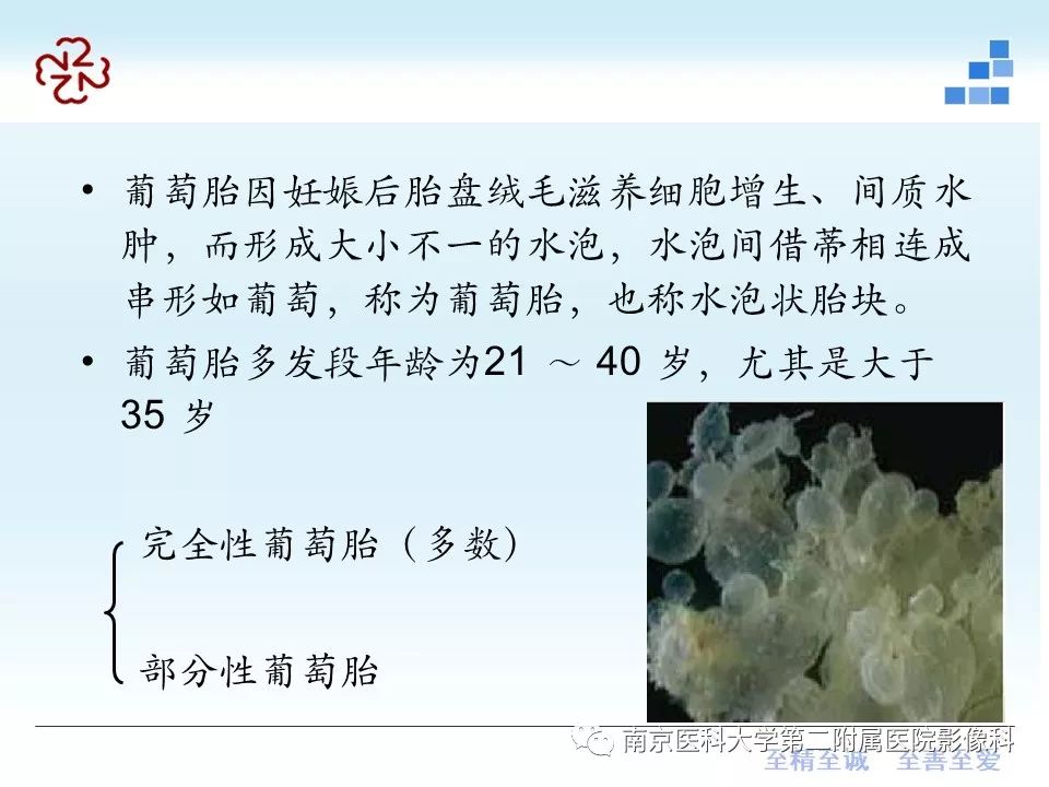 【PPT】葡萄胎的影像学诊断