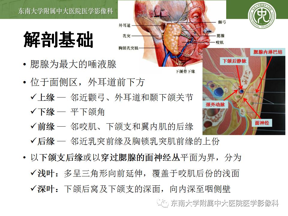 【病例】腮腺多形性腺瘤1例CT影像表现