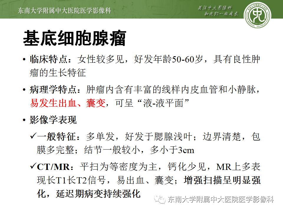 【病例】腮腺多形性腺瘤1例CT影像表现