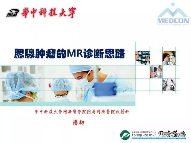 【PPT】腮腺肿瘤的MR诊断思路