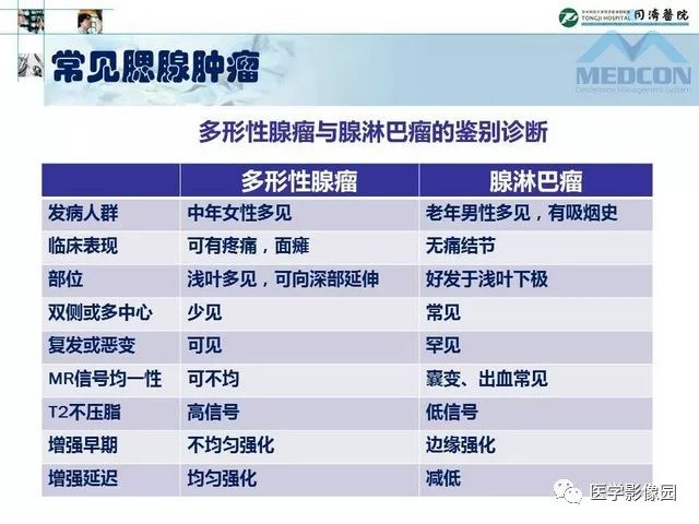 【PPT】腮腺肿瘤的MR诊断思路