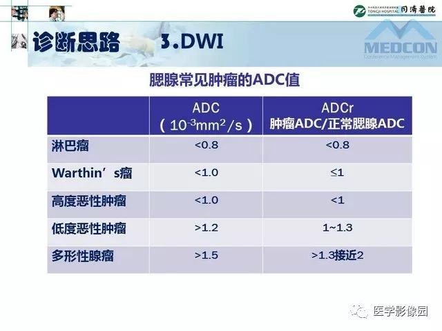 【PPT】腮腺肿瘤的MR诊断思路