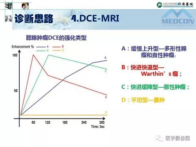 【PPT】腮腺肿瘤的MR诊断思路