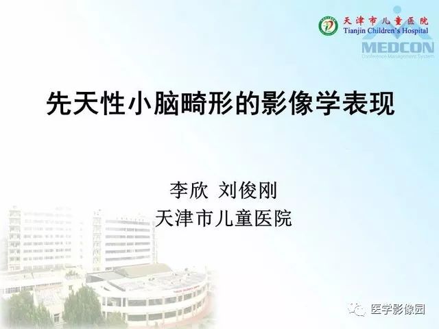 【PPT】先天性小脑畸形的影像学表现