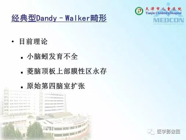 【PPT】先天性小脑畸形的影像学表现