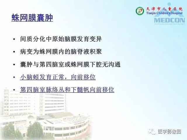 【PPT】先天性小脑畸形的影像学表现