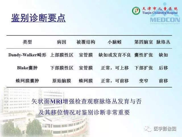 【PPT】先天性小脑畸形的影像学表现