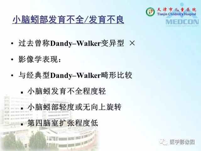 【PPT】先天性小脑畸形的影像学表现