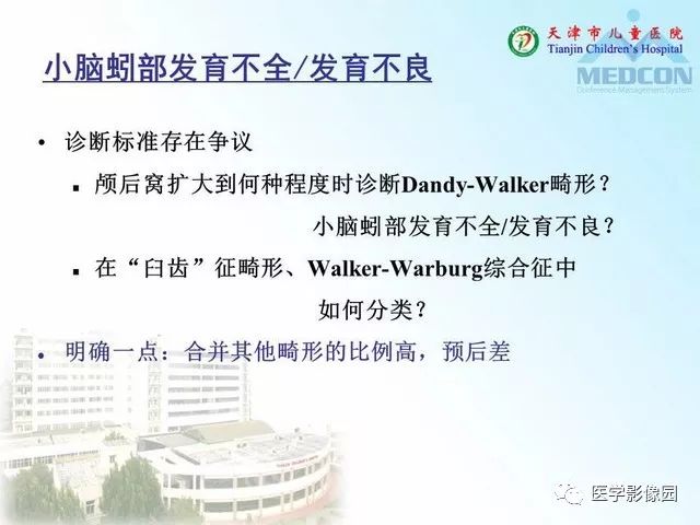 【PPT】先天性小脑畸形的影像学表现