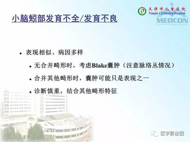 【PPT】先天性小脑畸形的影像学表现