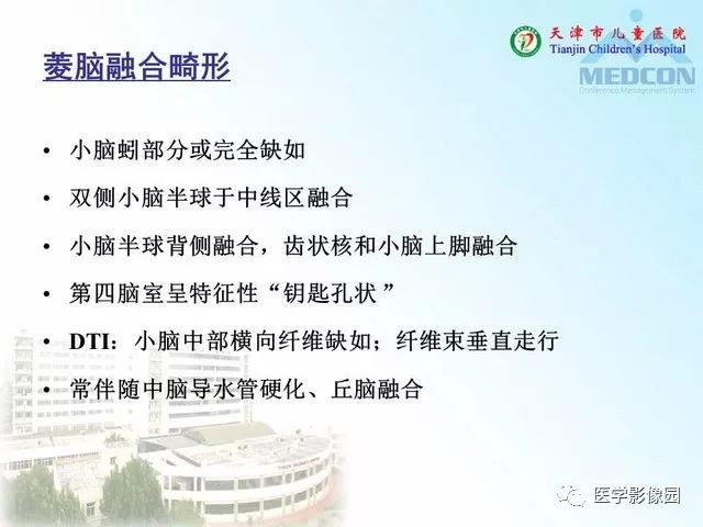【PPT】先天性小脑畸形的影像学表现