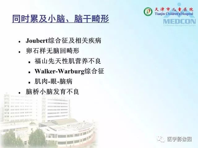 【PPT】先天性小脑畸形的影像学表现
