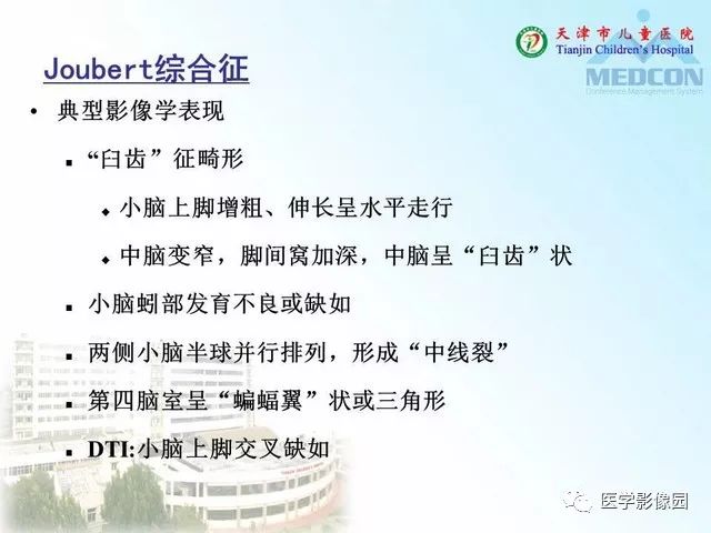 【PPT】先天性小脑畸形的影像学表现