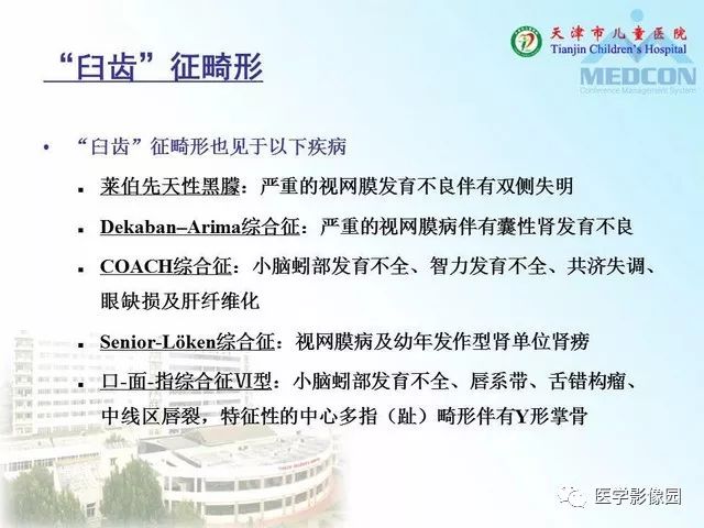 【PPT】先天性小脑畸形的影像学表现