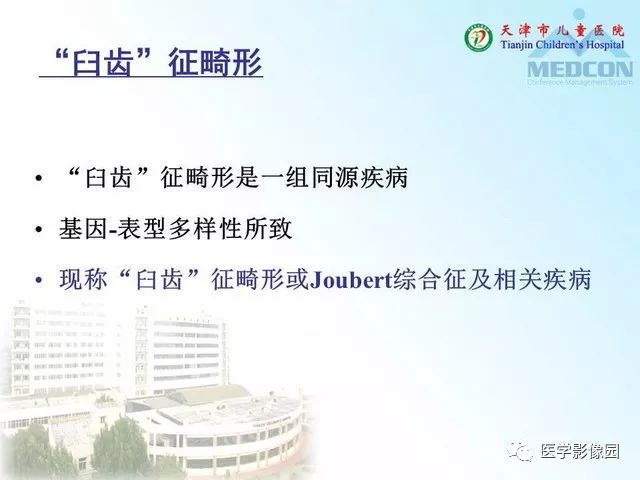 【PPT】先天性小脑畸形的影像学表现