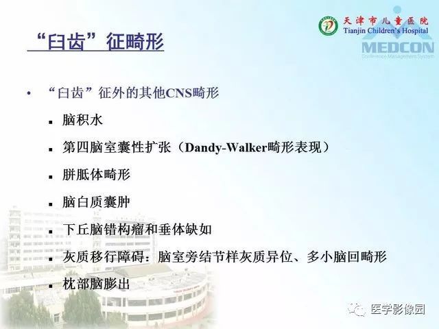 【PPT】先天性小脑畸形的影像学表现