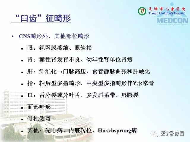 【PPT】先天性小脑畸形的影像学表现