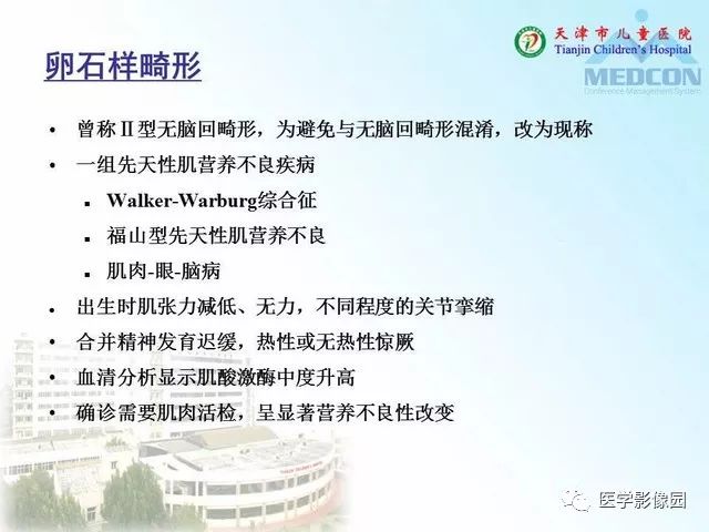 【PPT】先天性小脑畸形的影像学表现