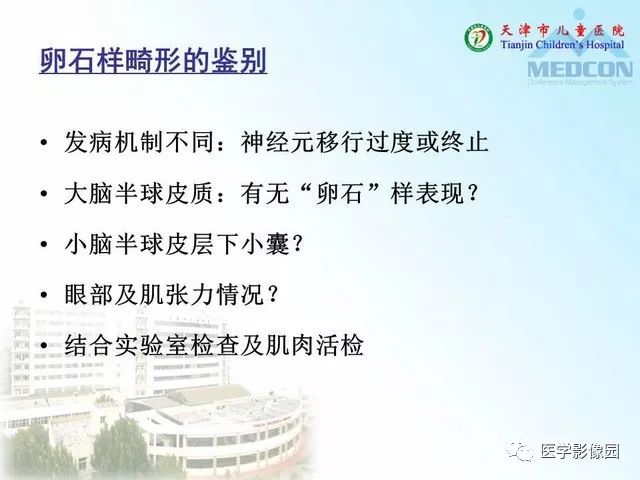 【PPT】先天性小脑畸形的影像学表现