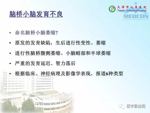 【PPT】先天性小脑畸形的影像学表现