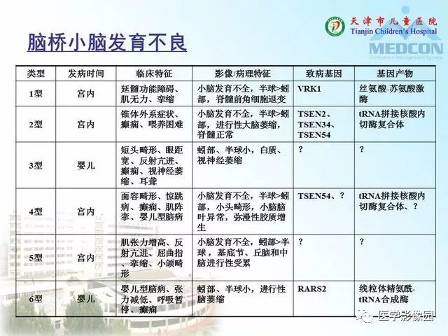 【PPT】先天性小脑畸形的影像学表现