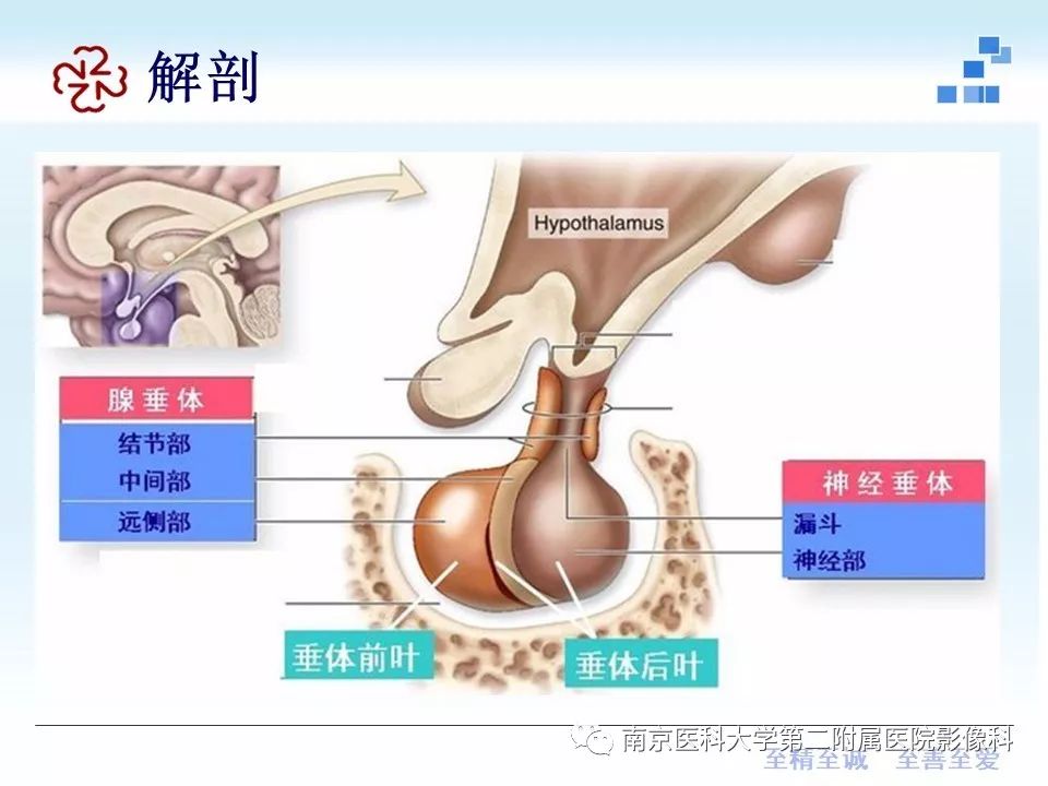 【PPT】专题读片—垂体柄阻断综合征