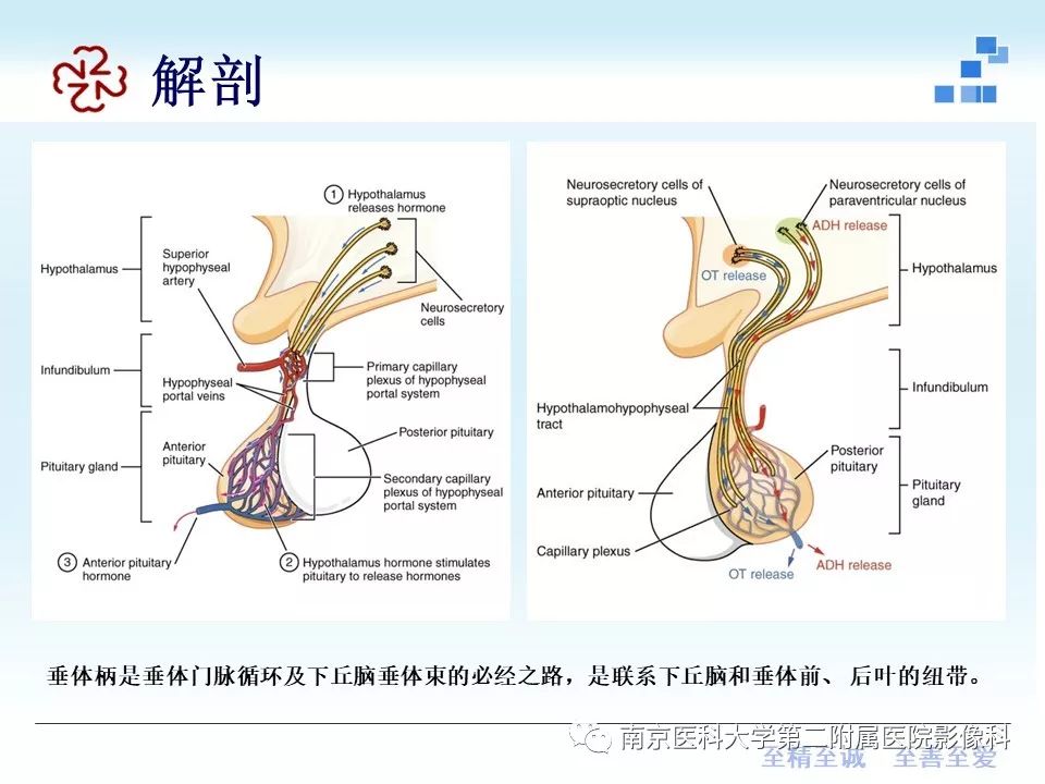 【PPT】专题读片—垂体柄阻断综合征