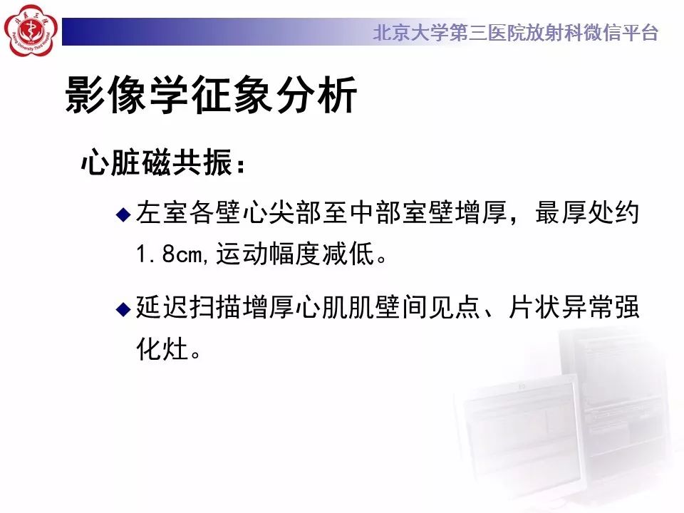 【病例】肥厚性心肌病1例MR