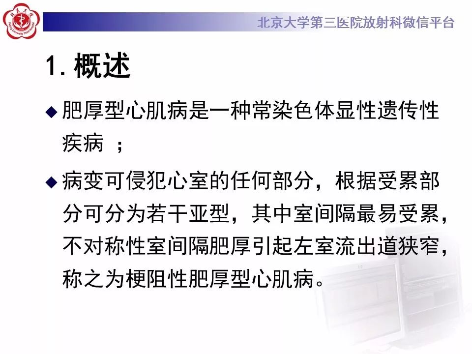 【病例】肥厚性心肌病1例MR