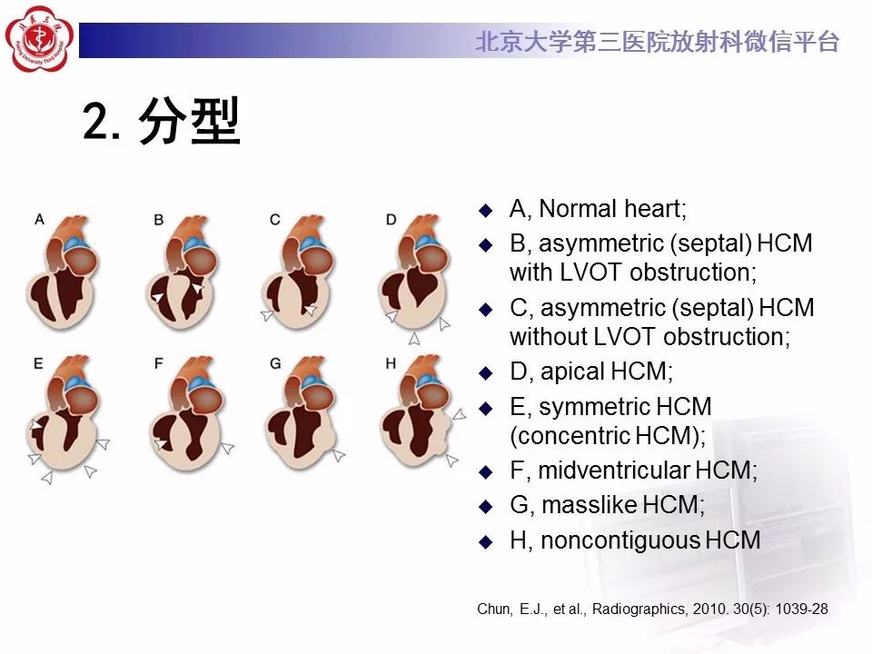 【病例】肥厚性心肌病1例MR