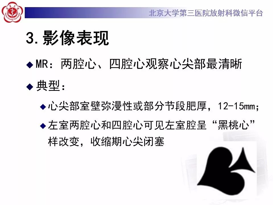 【病例】肥厚性心肌病1例MR
