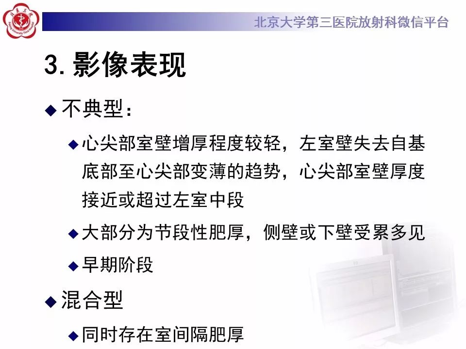 【病例】肥厚性心肌病1例MR