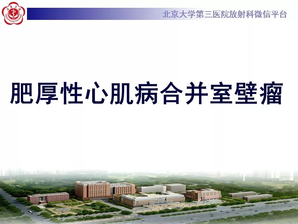 【病例】肥厚性心肌病1例MR