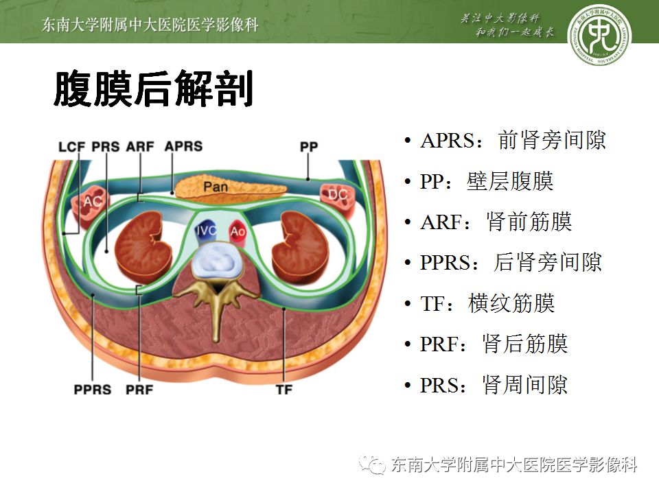 【病例】腹膜后巨淋巴结增生症VS炎性肌纤维母细胞瘤 【病例】腹膜后巨淋巴结增生症VS炎性肌纤维母细胞瘤