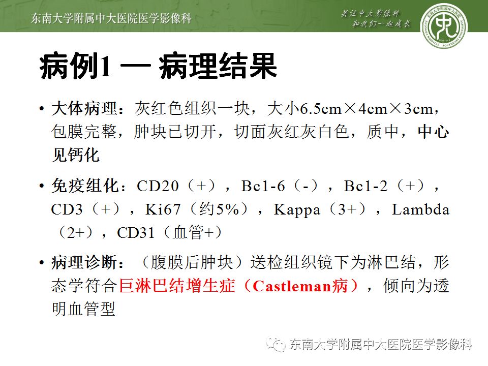 【病例】腹膜后巨淋巴结增生症VS炎性肌纤维母细胞瘤 【病例】腹膜后巨淋巴结增生症VS炎性肌纤维母细胞瘤