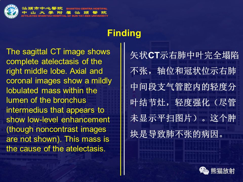 【病例】气管支气管粘液表皮样癌1例CT