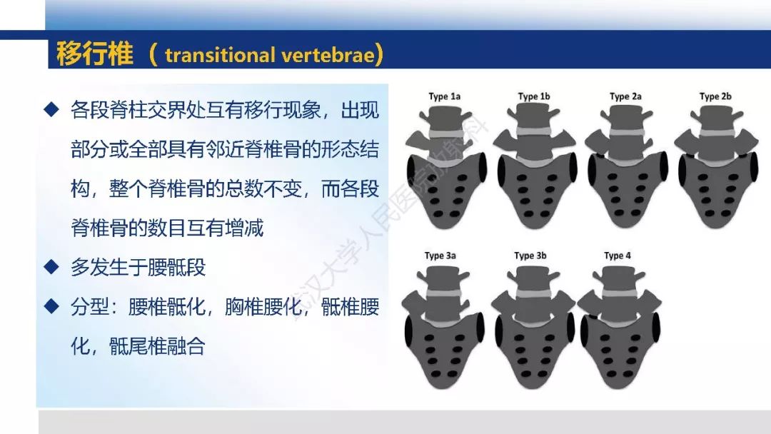 【PPT】先天性椎体畸形影像诊断