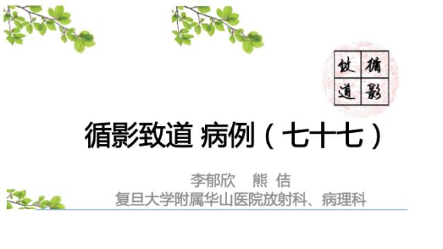【病例】中枢神经系统窦组织细胞增生症RDD一例 【病例】中枢神经系统窦组织细胞增生症RDD一例