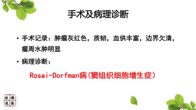 【病例】中枢神经系统窦组织细胞增生症RDD一例 【病例】中枢神经系统窦组织细胞增生症RDD一例